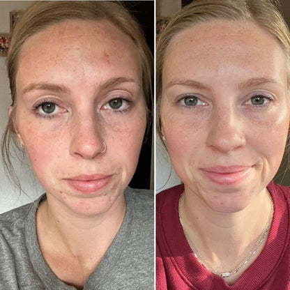 Hoygi Night Glow Eye Cream™