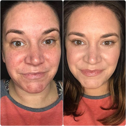 Hoygi Night Glow Eye Cream™