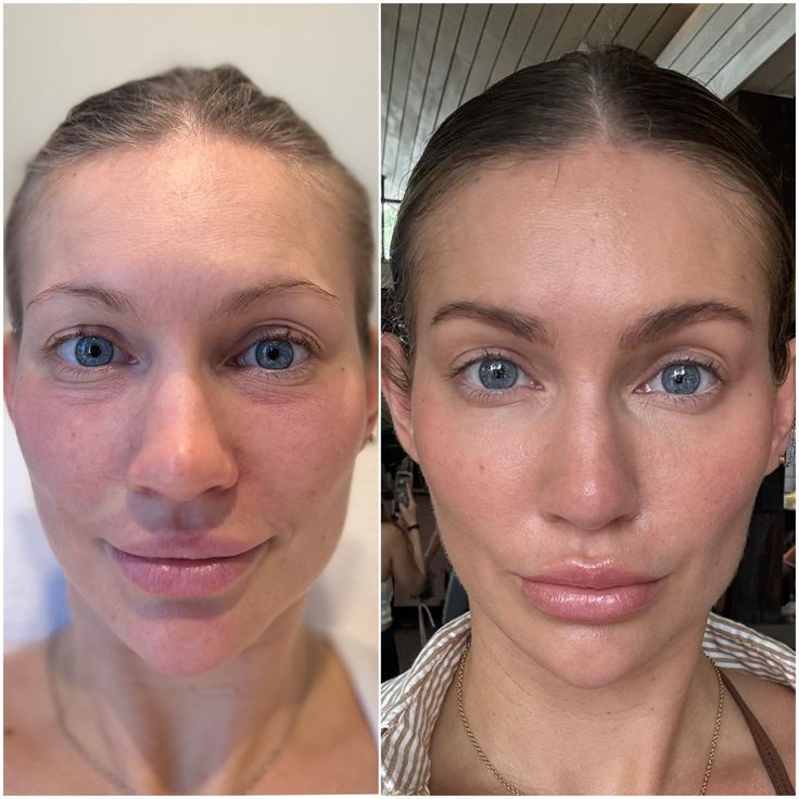 Hoygi Night Glow Eye Cream™