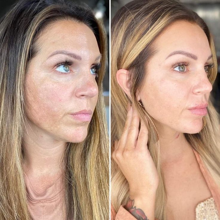 Hoygi Night Glow Eye Cream™